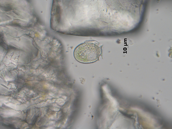 Você está visualizando atualmente Cetesb constata presença de microalgas tóxicas nas praias de Santos, São Sebastião e Peruíbe